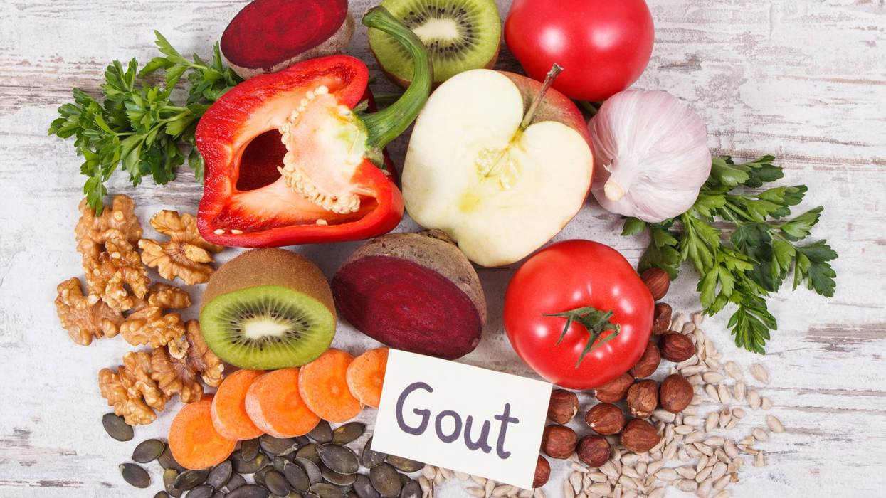 Cheat Sheet: Foods to Avoid with Gout