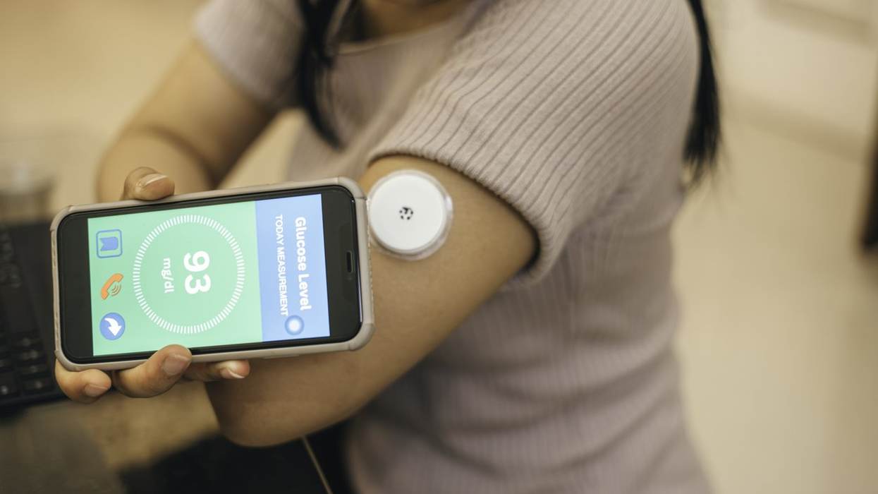 Continuous Glucose Monitors Go OTC