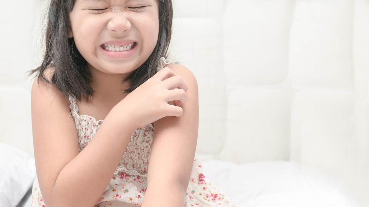 Eczema and Children: What Parents Can Do to Keep Their Kids Healthy