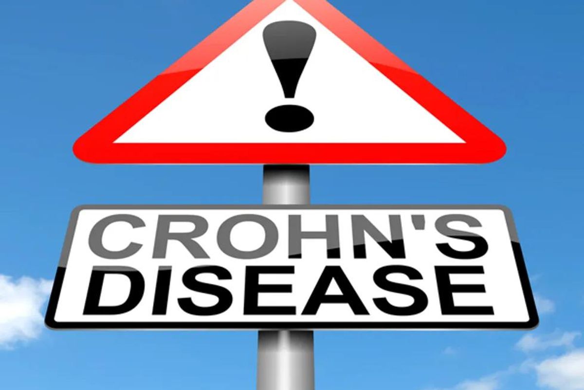 Good News for Crohn's Disease Patients