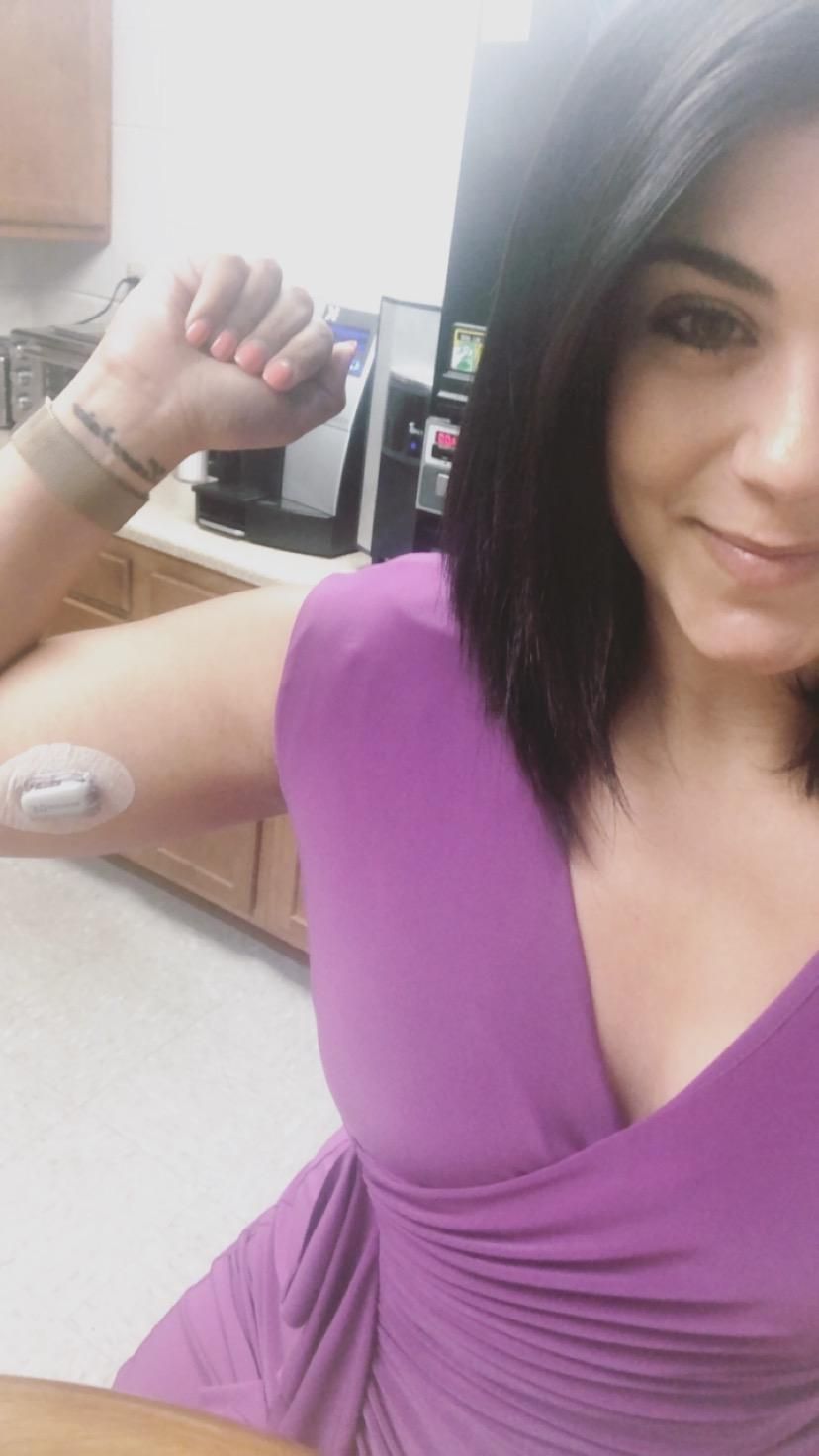 Grace Fernandez and her continuous glucose monitor, 2019