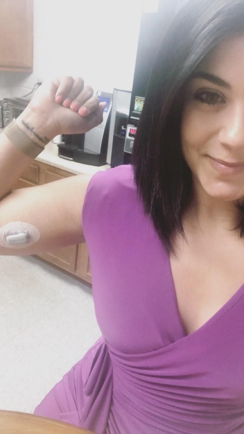 Grace Fernandez and her continuous glucose monitor, 2019
