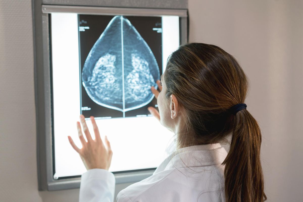 gynocologist looking at a mammogram