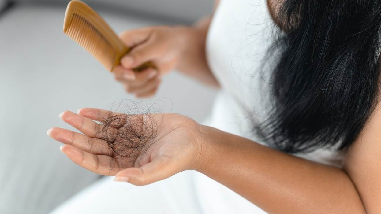 Hair Loss Affects Many Aspects of Life