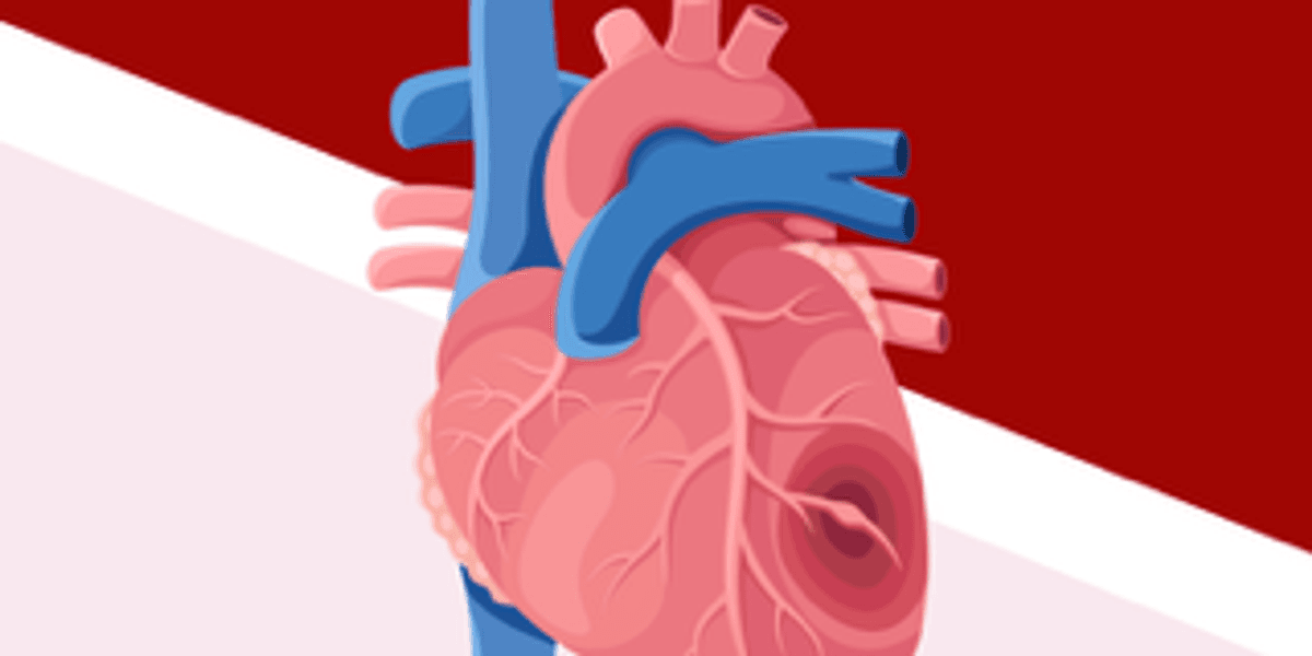 ¿Has escuchado hablar de la amiloidosis cardíaca por transtiretina (ATTR-CM)?