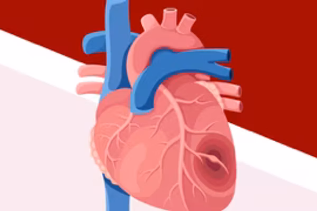 ¿Has escuchado hablar de la amiloidosis cardíaca por transtiretina (ATTR-CM)? infographic