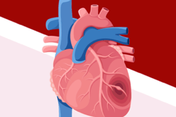 ¿Has escuchado hablar de la amiloidosis cardíaca por transtiretina (ATTR-CM)? infographic