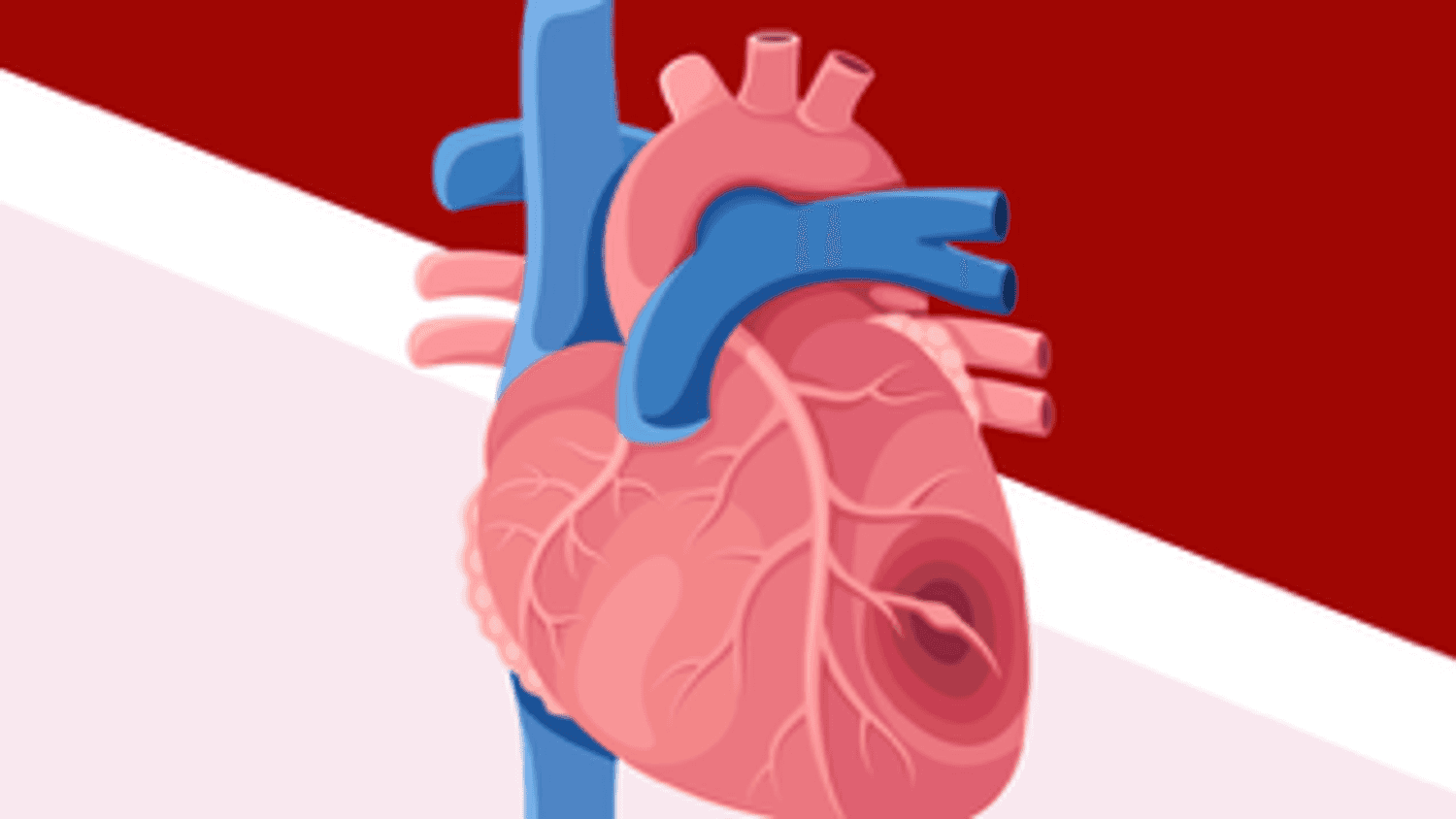 Have you heard of ATTR-Cardiac Amyloidosis (ATTR-CM)?