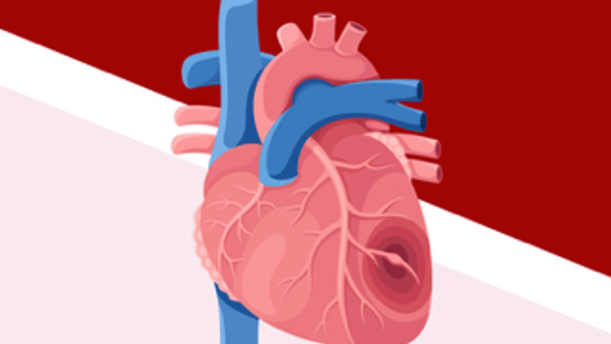 Have you heard of ATTR-Cardiac Amyloidosis (ATTR-CM)? infographic