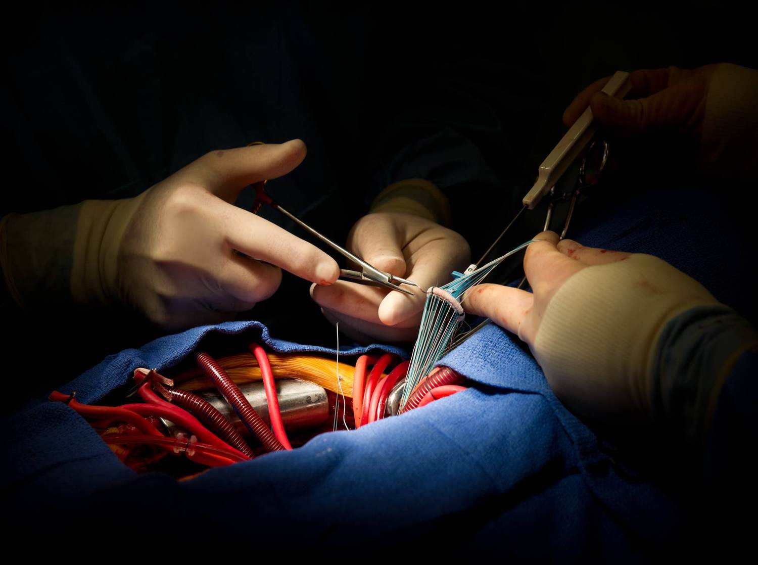 Heart Valve Disease: Symptoms, Treatment and What Patients Should Know