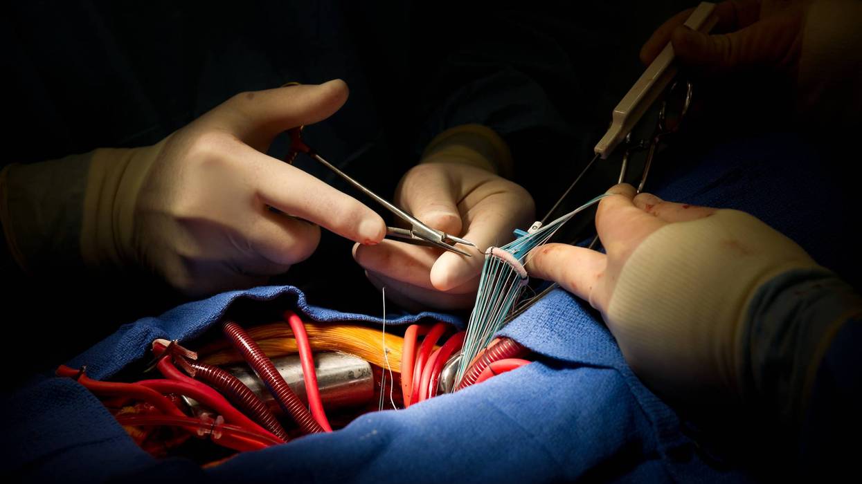 Heart Surgery Aortic Valve Replacement