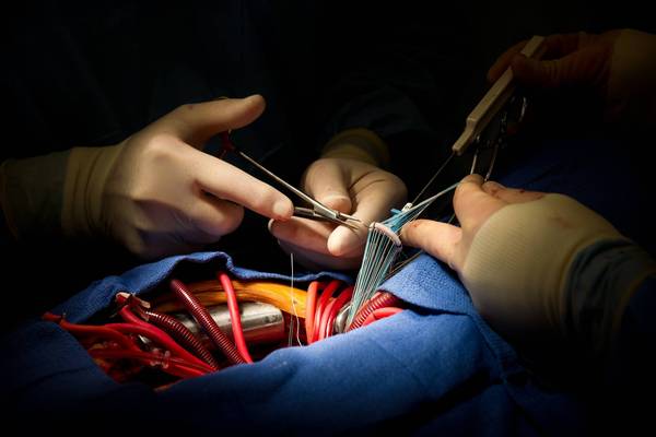 Heart Surgery Aortic Valve Replacement
