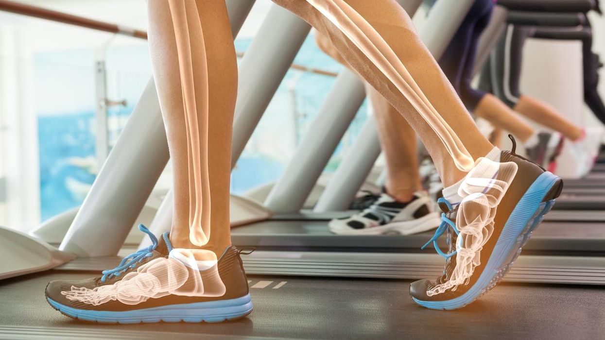 Highlighted bones of person on treadmill