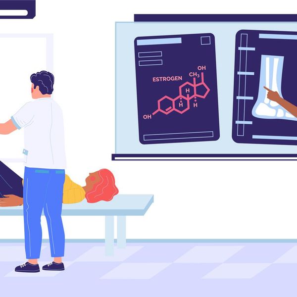 How Do Hormones Affect Osteoporosis?