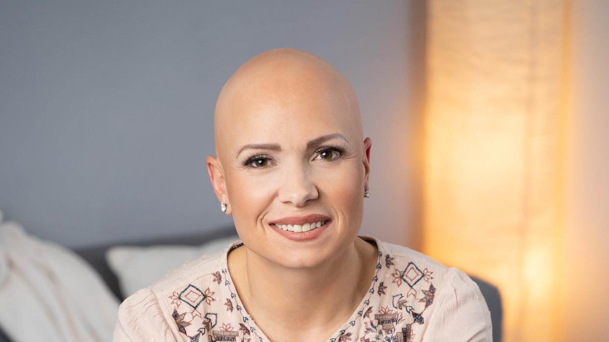 How I Learned to Love My Bald Self