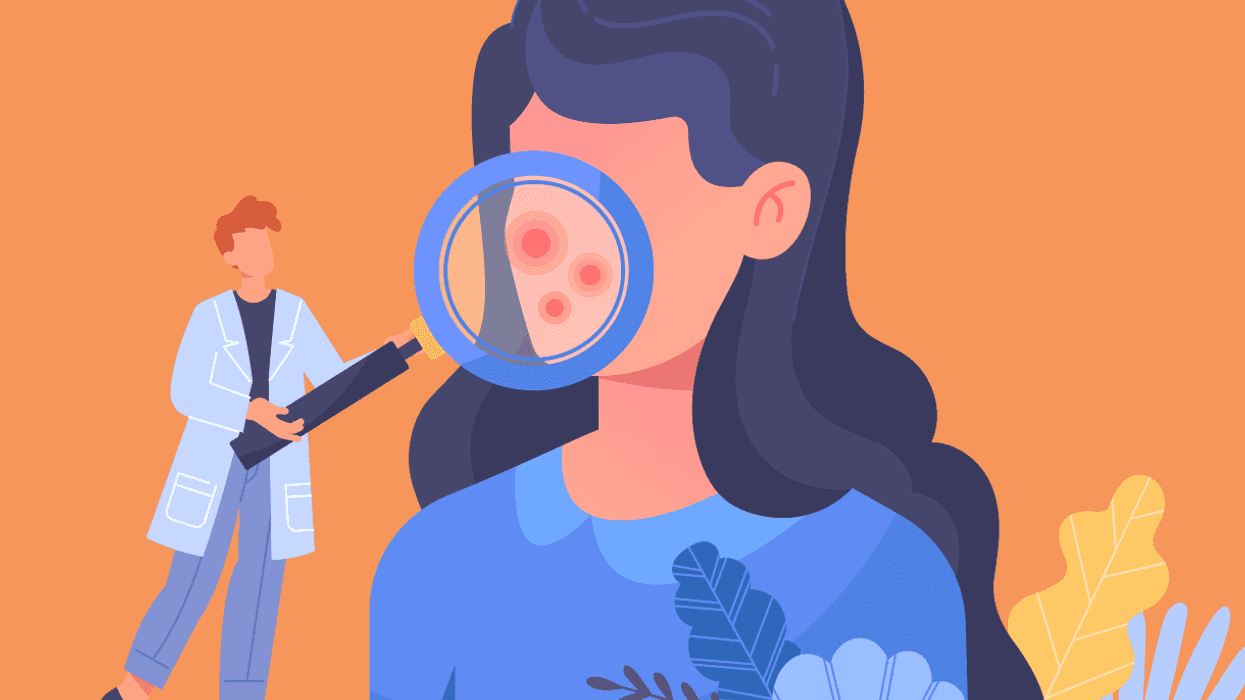 How Psoriasis Changes as Women Age