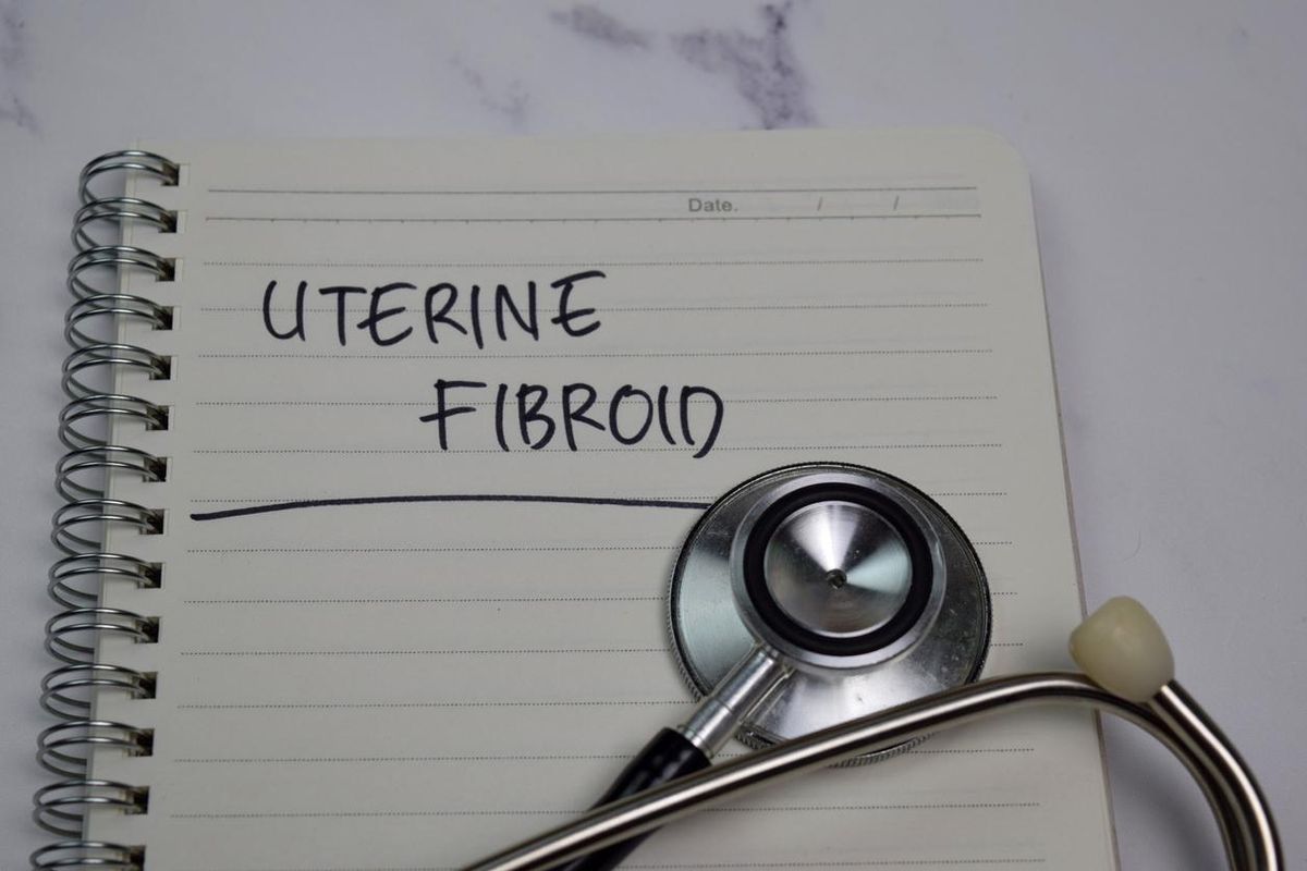How to Choose Health Insurance When You Have Fibroids