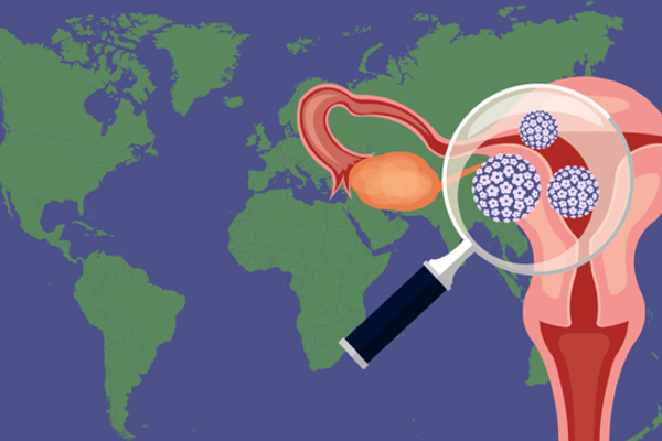 HPV Vaccination Around the World Infographic
