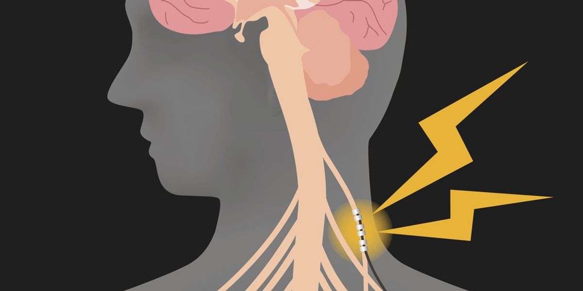 What Is the Vagus Nerve?