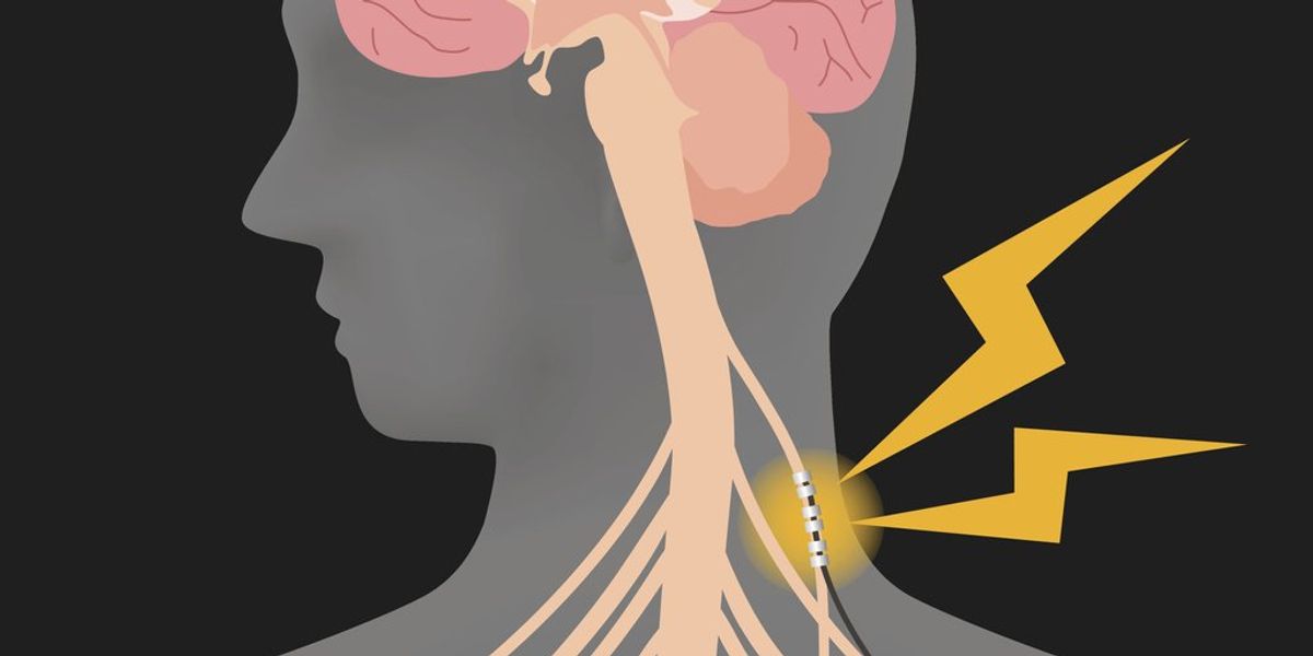 What Is the Vagus Nerve? - HealthyWomen