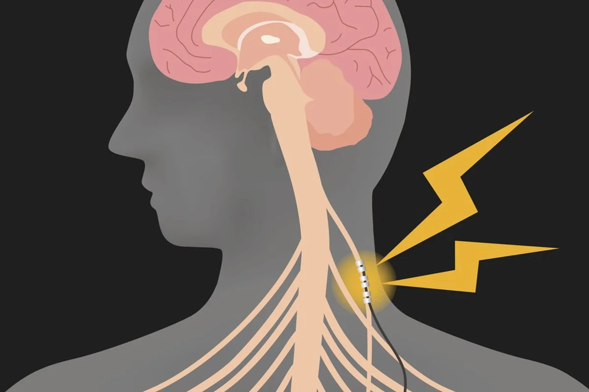 human brain and vagus nerve stimulation