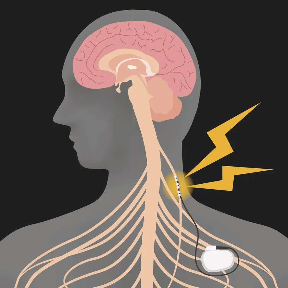 human brain and vagus nerve stimulation