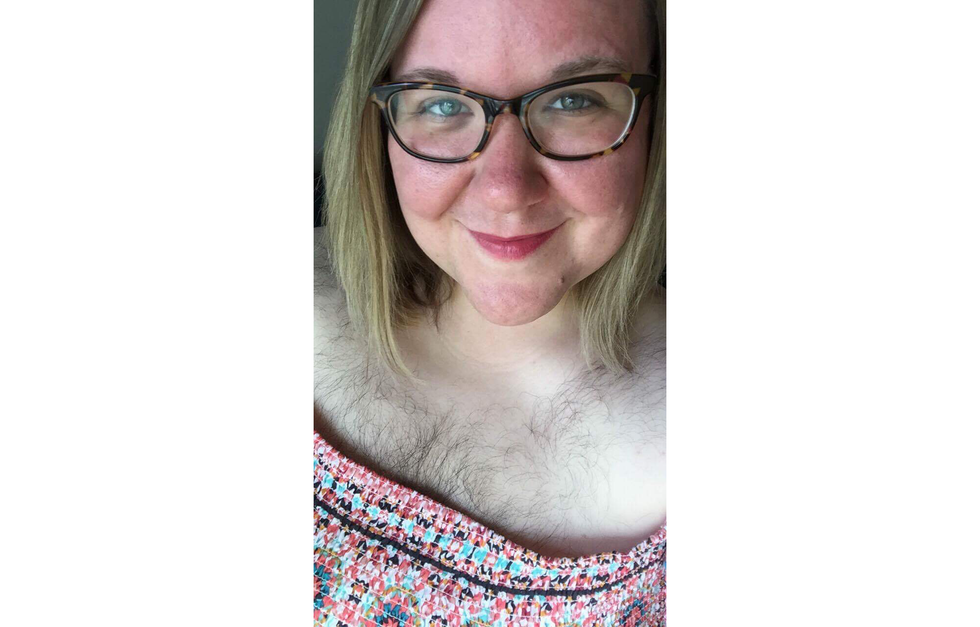 I am a Hairy Woman Due to PCOS—And I am Happy and Proud of It