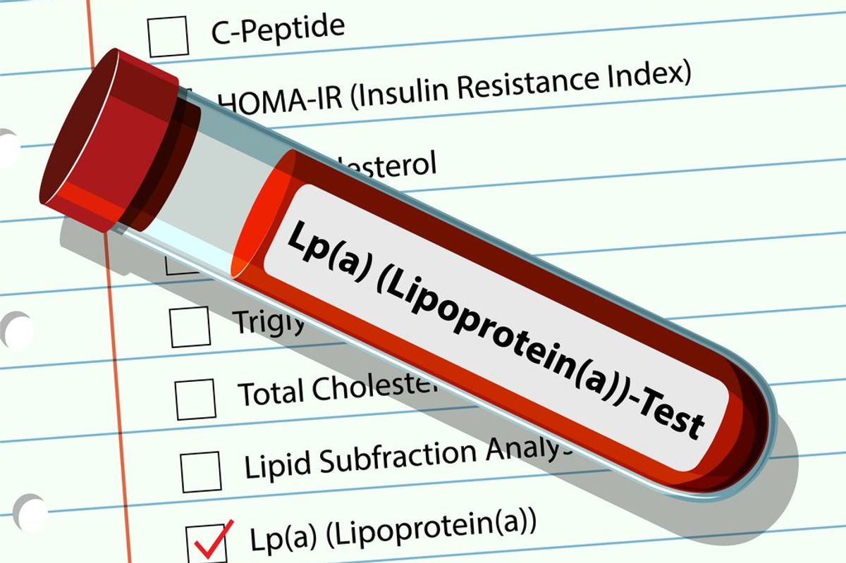 Illustration of a blood test for Lipoprotein(a)