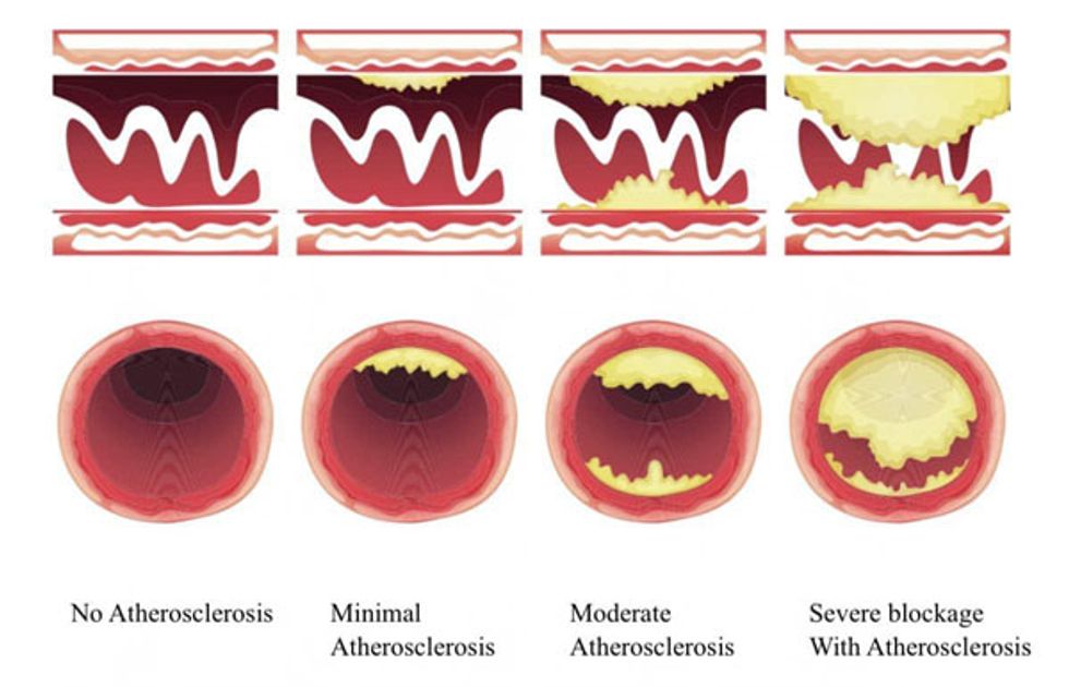 illustrations of arteries