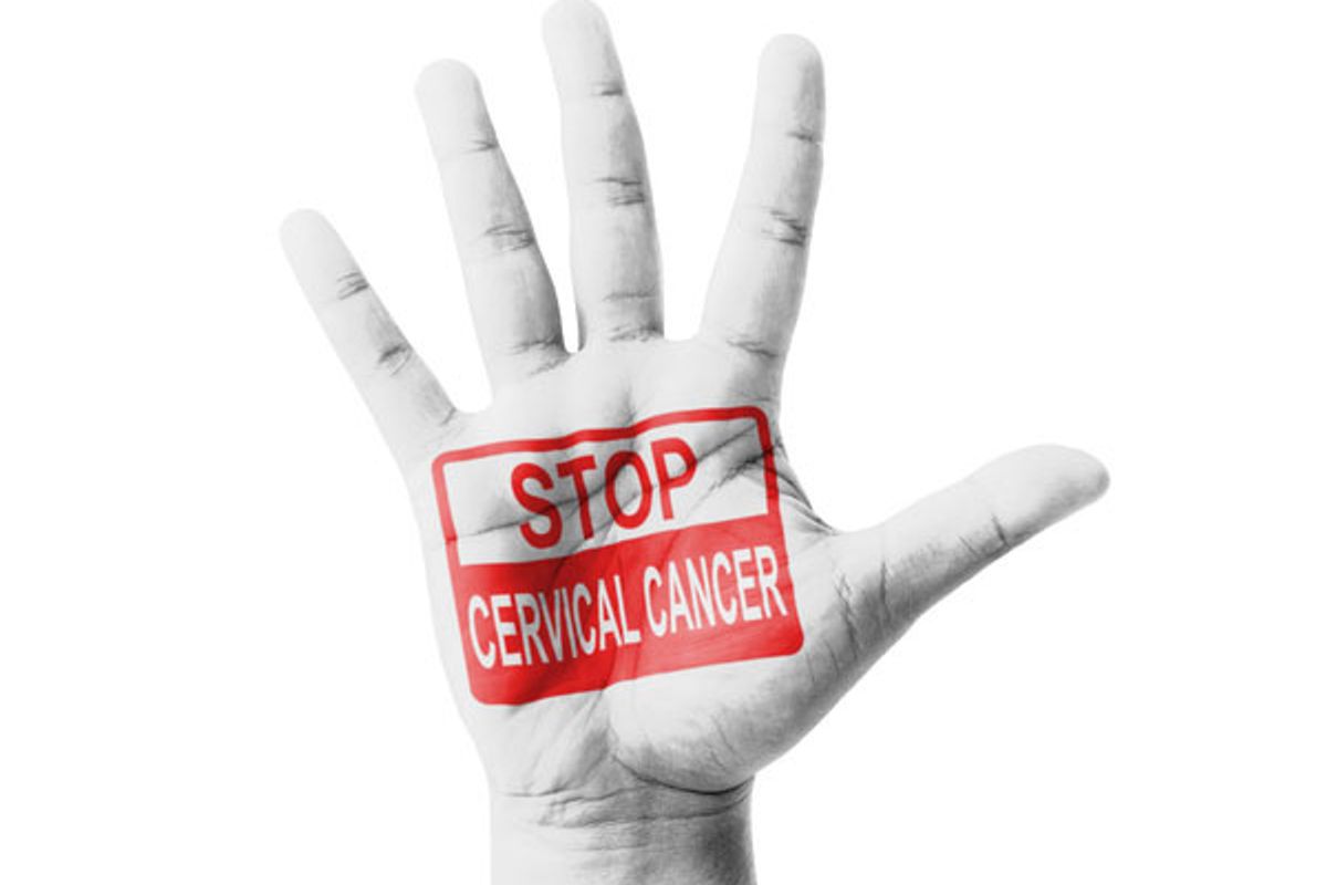 How You Can Easily Reduce Your Risk for Cervical Cancer