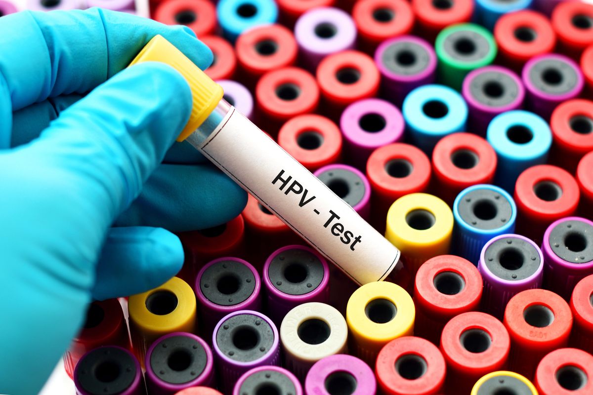 Is the HPV test Necessary?
