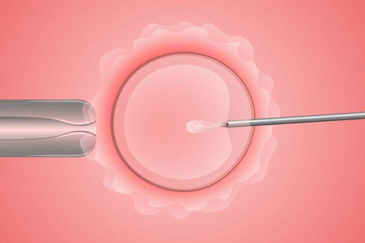 IVF Won't Raise Risk for Breast Cancer