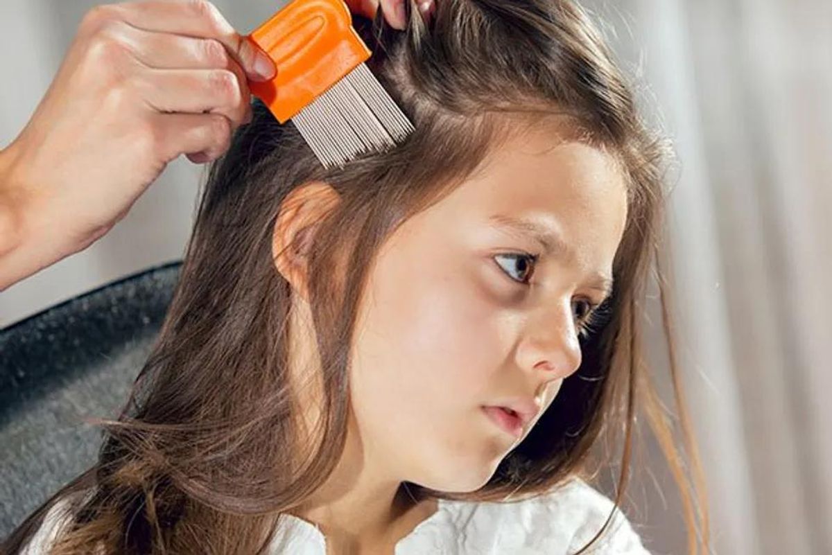 'Superlice' Resist Most Over-the-Counter Remedies