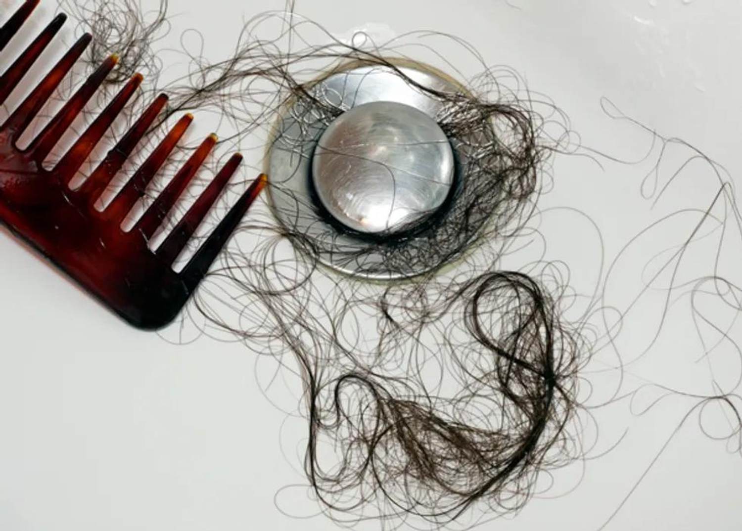 Is It Female Pattern Baldness—or Normal Hair Loss?