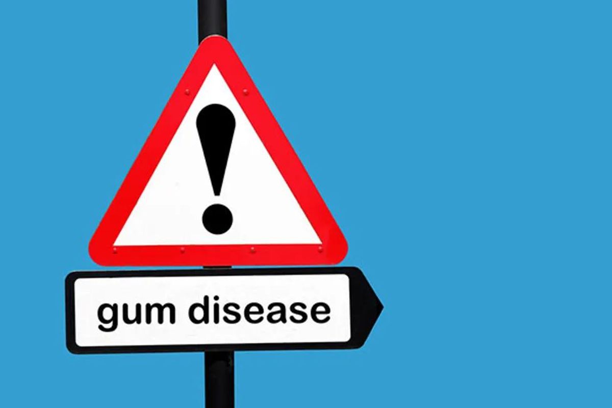 Can Gum Disease Increase Your Breast Cancer Risk?