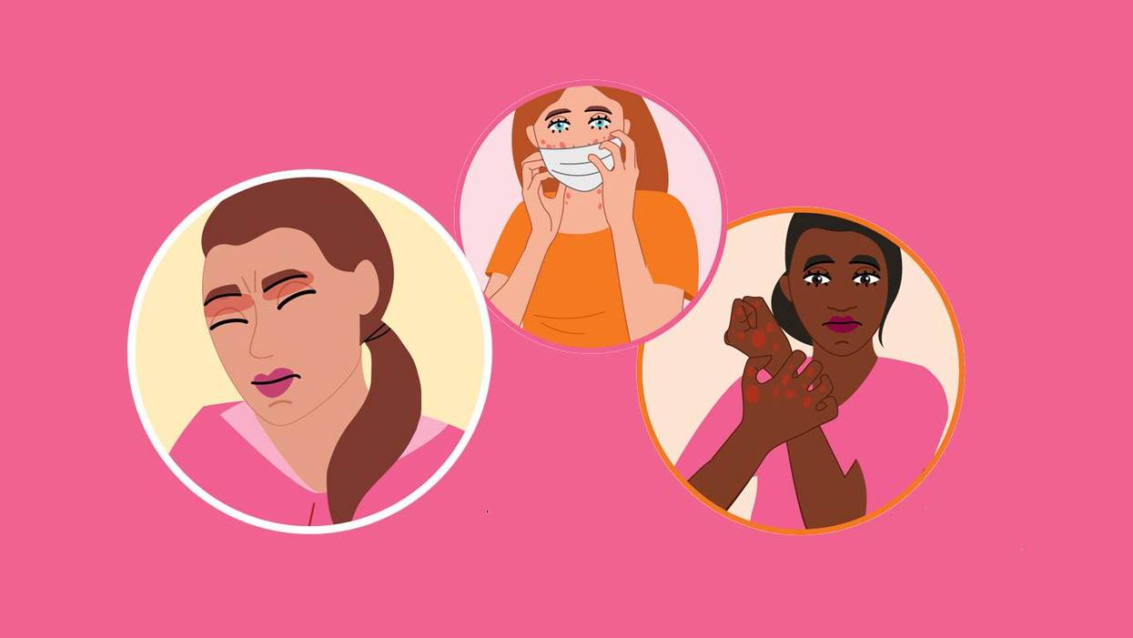 Coping With Atopic Dermatitis