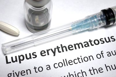 Lupus erythematous