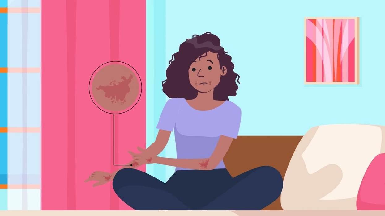 What Is Step Therapy?
