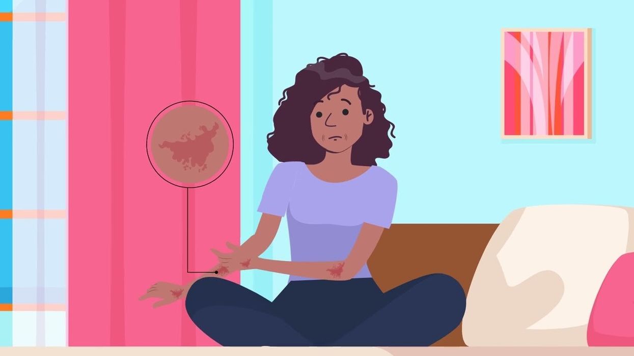 What Is Step Therapy?