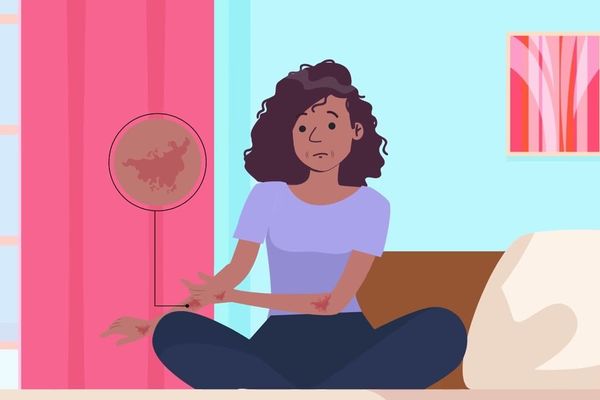 What Is Step Therapy?