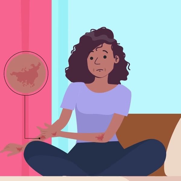 What Is Step Therapy?