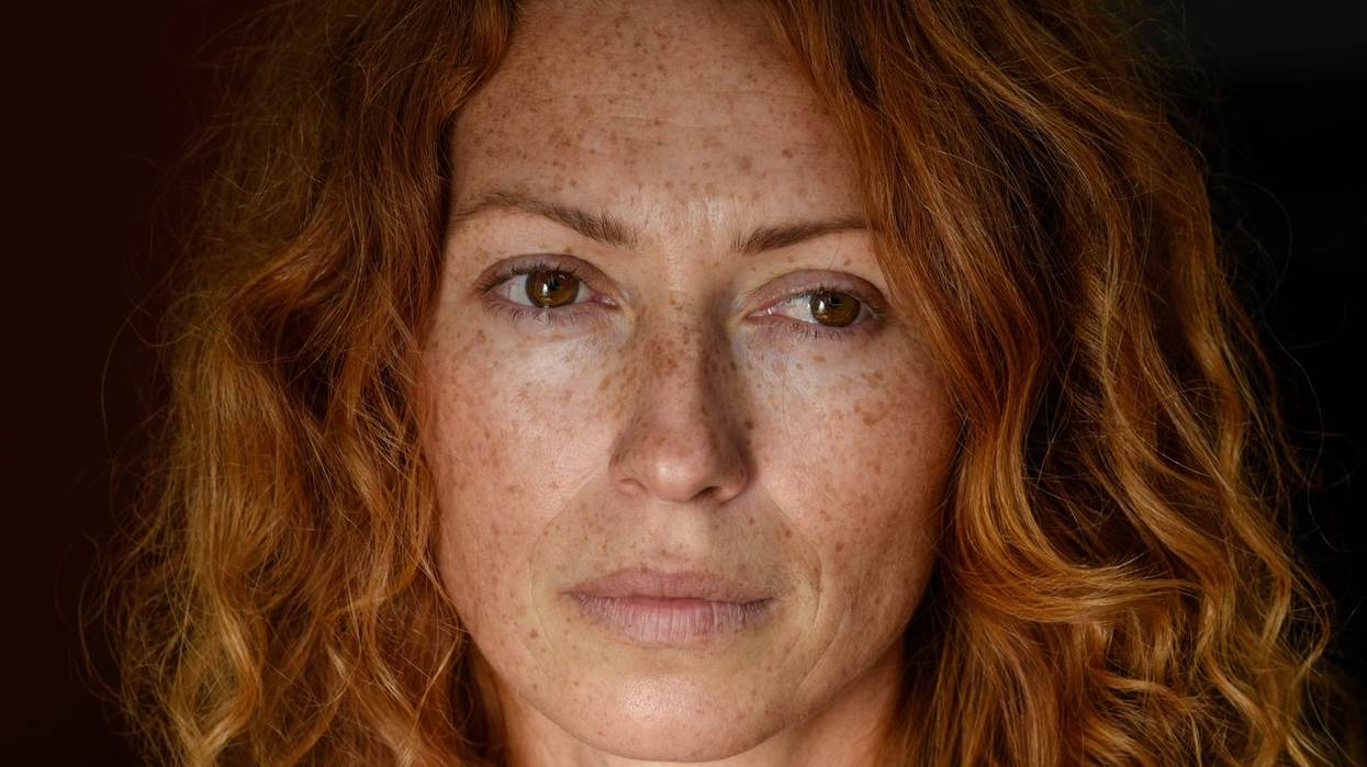 Redheads and Pain