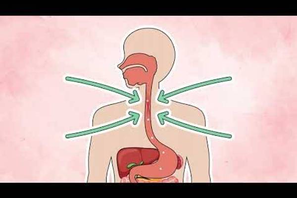 How EoE Affects Your Daily Life