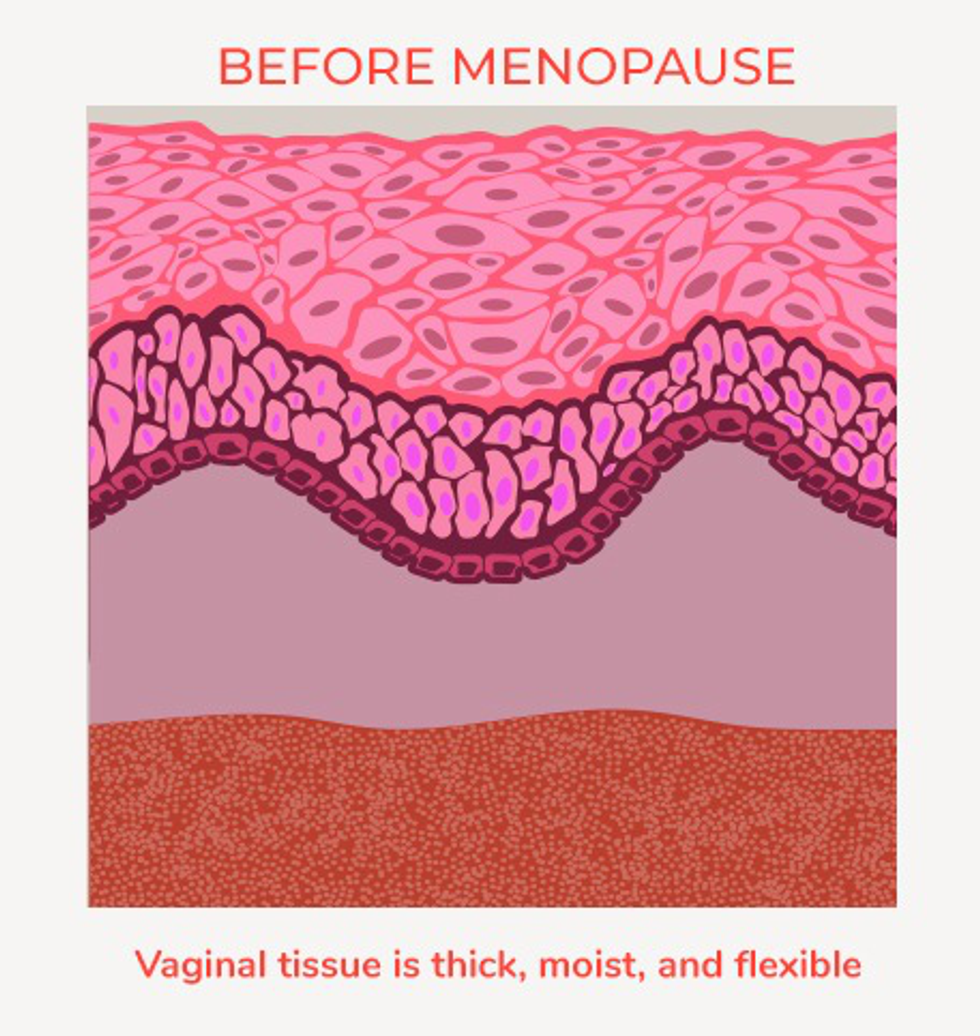 If You Experience PostMenopausal Painful Sex, Speak Up! HealthyWomen