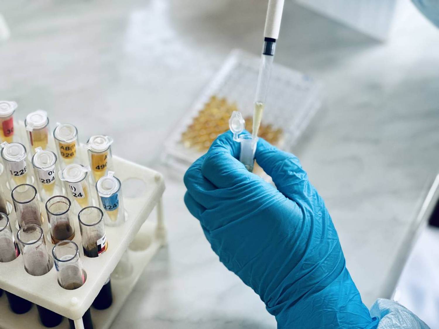 FAQs About Colorectal Cancer Biomarkers