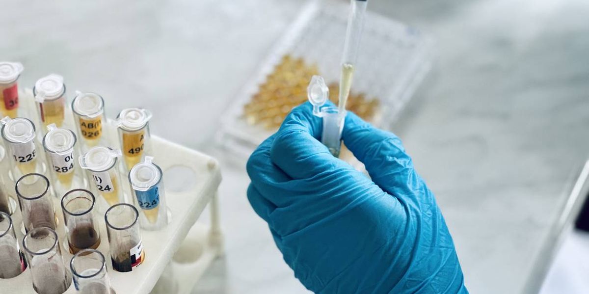 Immunology or serology testing method in medical laboratory
