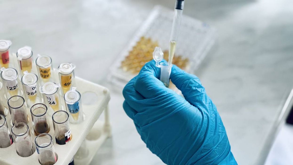 Immunology or serology testing method in medical laboratory