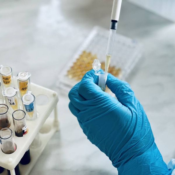 Immunology or serology testing method in medical laboratory