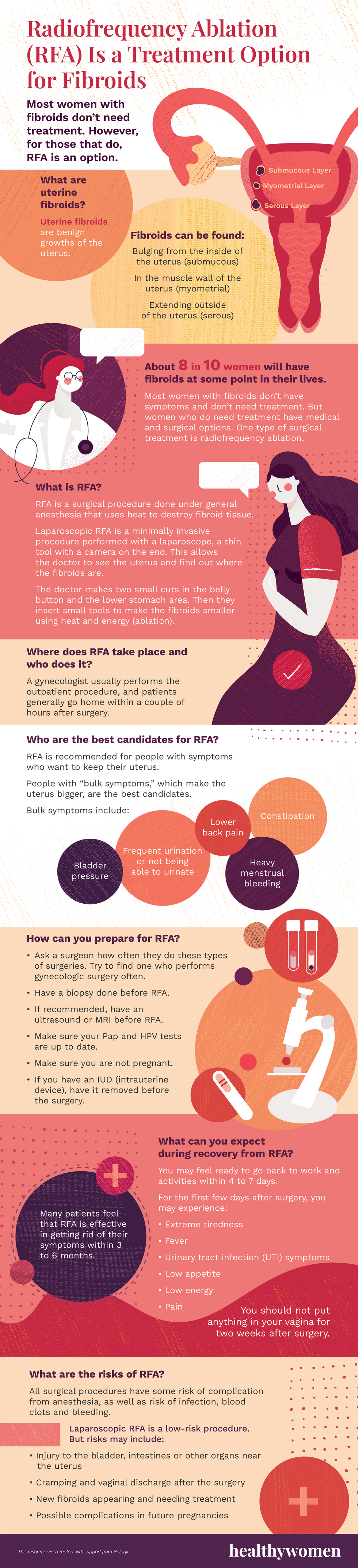 Infographic Radiofrequency Ablation (RFA) Is a Treatment Option for Fibroids. Click the image to open the PDF