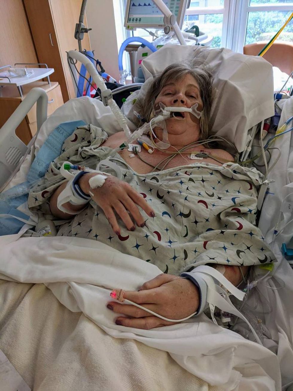 Jackie in shock trauma ICU after suffering from septic shock, 2021.